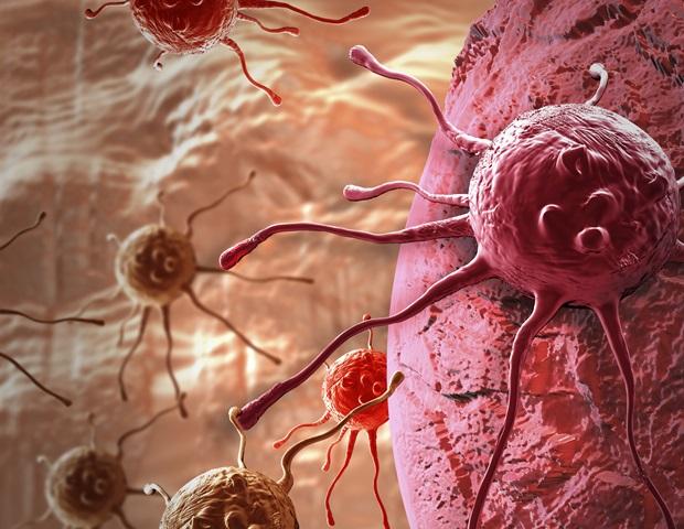 سطح cfDNA پس از جراحی سرطان روده بزرگ دو برابر میشود